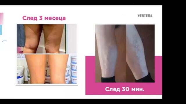 Резилтат с Хашимото