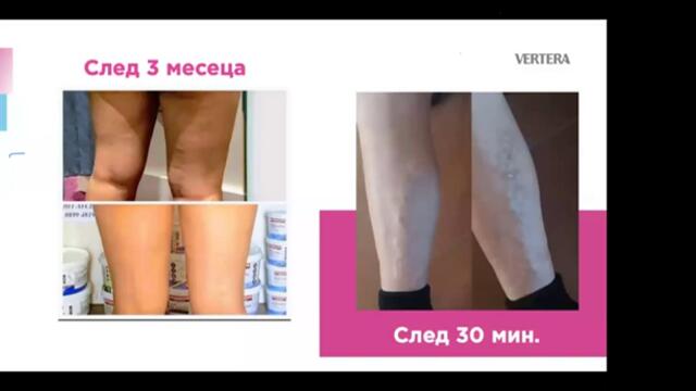 Резултат с проблем на щитовидната жлеза