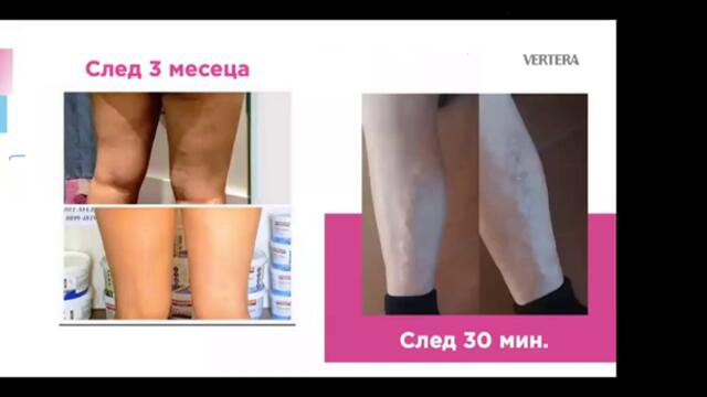 Резултат с  антицелолит