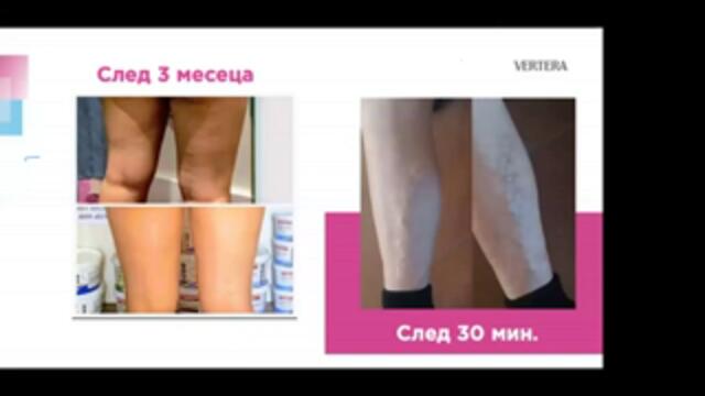 Резултат с намаляване на диоптера