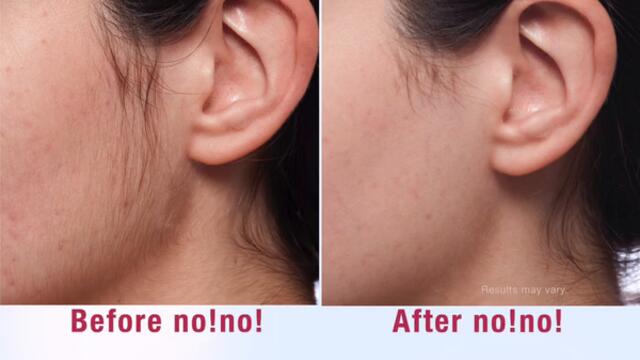 cta_2017  NO! Hair boy and girl TV